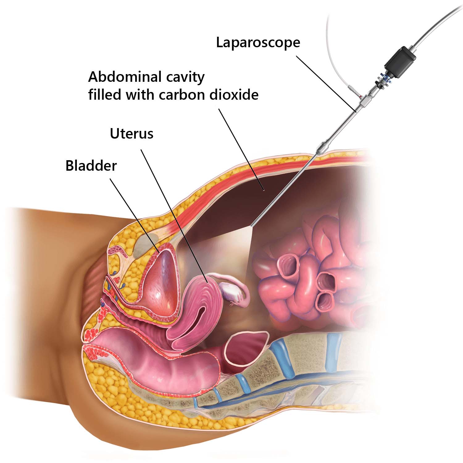 https://draladdinbadawi.com/wp-content/uploads/2019/01/diagnostic-laparoscopy.jpg